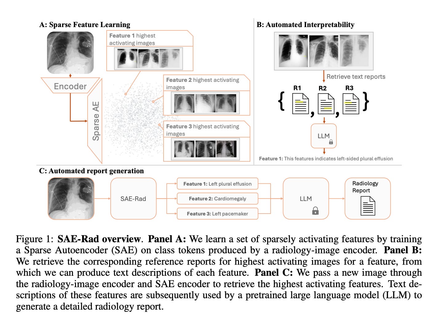 Figure from the SAE-Rad paper: a sparse autoencoder extracts features from the X-ray, they are interpreted with reference reports, and a constrained LLM generates the report