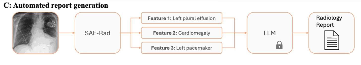 Panel C of SAE-Rad: the image goes through SAE-Rad, which extracts clinical features (pleural effusion, cardiomegaly, pacemaker), and an LLM writes the radiology report